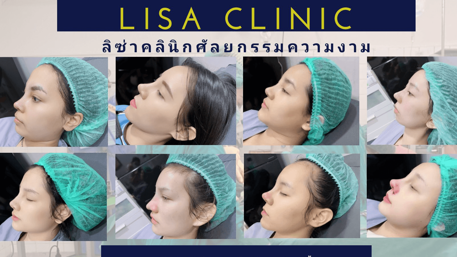 ลิซ่า คลินิก